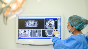 Tratamentul cu implant dentar: Ce opțiuni ai în 2025?